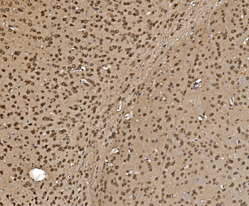 Proteasome 20S beta 7/PSMB7 Rabbit Polyclonal Antibody