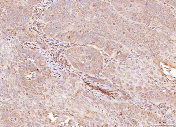 NDUFB8 Rabbit Polyclonal Antibody