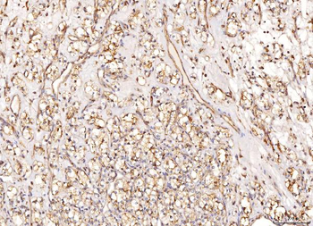NDUFB8 Rabbit Polyclonal Antibody