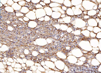 NDUFB8 Rabbit Polyclonal Antibody