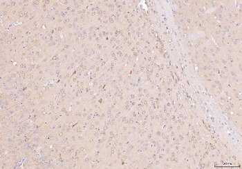 NDUFB8 Rabbit Polyclonal Antibody