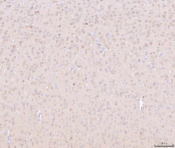 NDUFB8 Rabbit Polyclonal Antibody