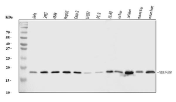 NDUFB8 Rabbit Polyclonal Antibody