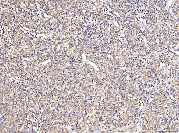MT-CO2/MT Rabbit Polyclonal Antibody