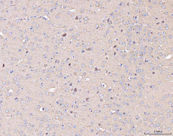 MT-CO2/MT Rabbit Polyclonal Antibody