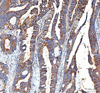 Integrin alpha 3/ITGA3 Antibody