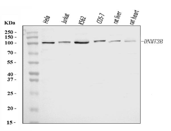 DNMT3B Rabbit Polyclonal Antibody