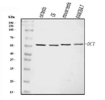 TRP2/DCT Rabbit Polyclonal Antibody