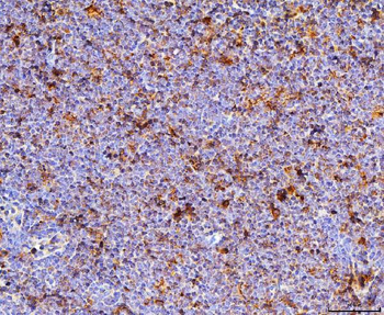 Cd70 Rabbit Polyclonal Antibody