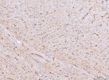 Aquaporin 4/AQP4 Antibody