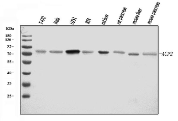 ACP2 Rabbit Polyclonal Antibody
