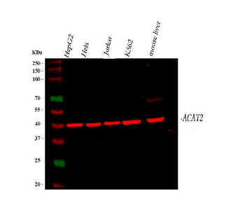 ACAT2 Rabbit Polyclonal Antibody