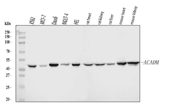 ACADM/MCAD Antibody