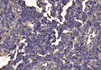 PDIA6 Antibody (monoclonal, 3H5E7)