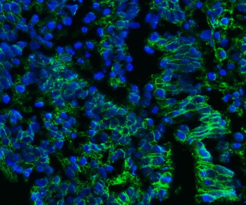 CD147/Emmprin Antibody (monoclonal, 7H5E7)