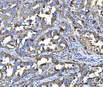 CD147/Emmprin Antibody (monoclonal, 7H5E7)
