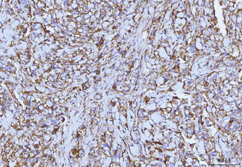 CD147/Emmprin Antibody (monoclonal, 3B13G7)