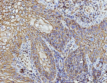 CD147/Emmprin Antibody (monoclonal, 3B13G7)