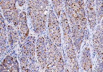 Cdk2 Mouse Monoclonal Antibody