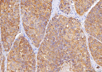 Sorbitol Dehydrogenase/SORD Mouse Monoclonal Antibody