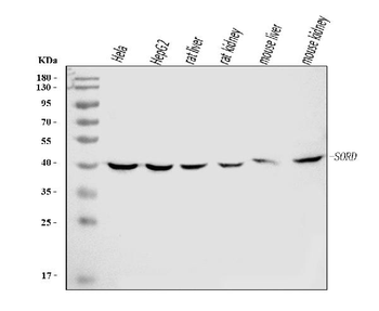 Sorbitol Dehydrogenase/SORD Mouse Monoclonal Antibody