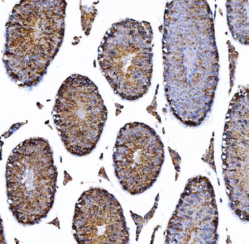 HGS Antibody (monoclonal, 4B7E2)
