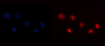 YY1 Mouse Monoclonal Antibody