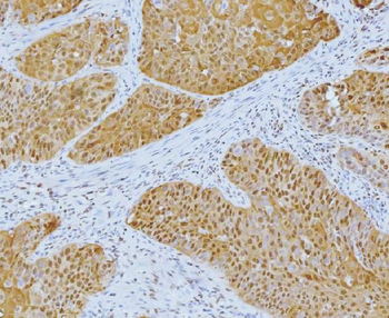 YY1 Mouse Monoclonal Antibody