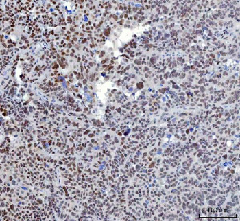 YY1 Mouse Monoclonal Antibody