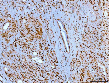 YY1 Mouse Monoclonal Antibody