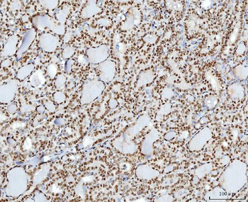 YY1 Mouse Monoclonal Antibody