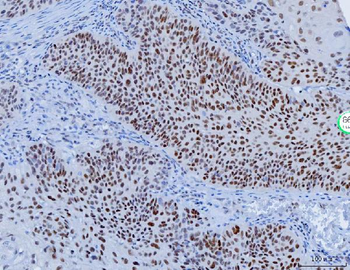 YY1 Mouse Monoclonal Antibody