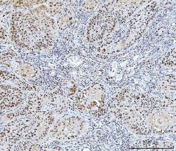 FEN1 Antibody (monoclonal, 7D11D7)