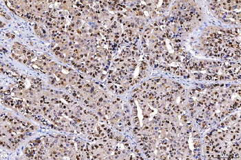 FEN1 Antibody (monoclonal, 6F3F2)