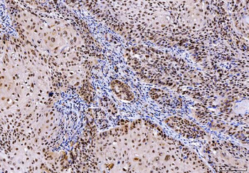 SHP1/PTPN6 Mouse Monoclonal Antibody