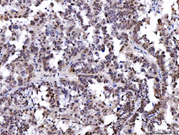 SHP1/PTPN6 Mouse Monoclonal Antibody