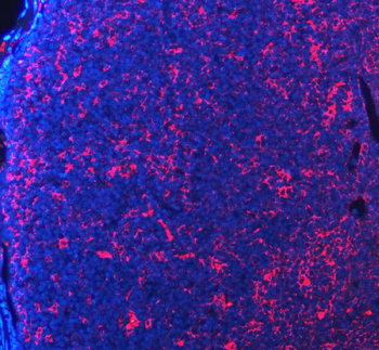 PD-1/PDCD1/PD Rabbit Polyclonal Antibody