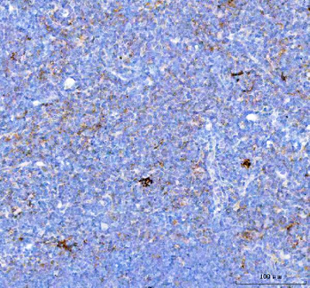 PD-1/PDCD1/PD Rabbit Polyclonal Antibody