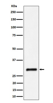 CBR1 Rabbit Monoclonal Antibody