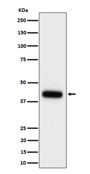 Clusterin Rabbit Monoclonal Antibody