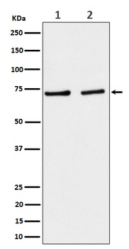 SLC25A12 Rabbit Monoclonal Antibody