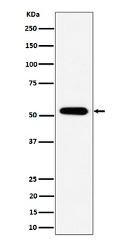 PPP2R5E Rabbit Monoclonal Antibody