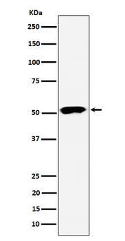PPP2R5E Rabbit Monoclonal Antibody