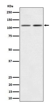 PI3 Kinase p110 beta Rabbit Monoclonal Antibody