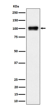 Nesprin3 Rabbit Monoclonal Antibody