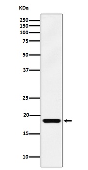 EMC4 Rabbit Monoclonal Antibody