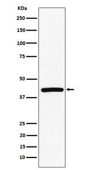 TMEM43 Rabbit Monoclonal Antibody