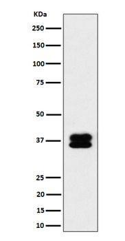 PCBP2 Rabbit Monoclonal Antibody