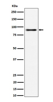 ACAP2 Rabbit Monoclonal Antibody