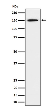 SAFB Rabbit Monoclonal Antibody